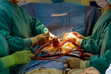 Advanced CABG